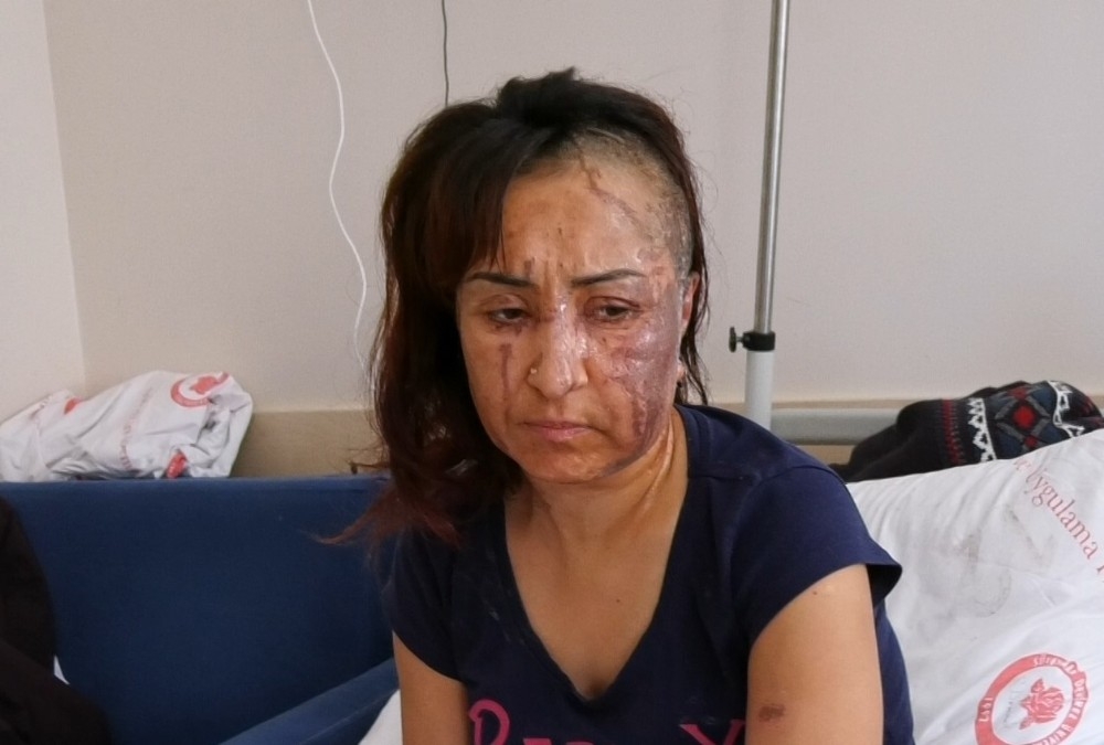 Boşanmak isteyen eşine kezzapla saldırdı