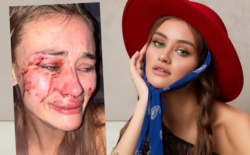 Çeşme'deki o mekanda geçen yıl da olay çıkmış