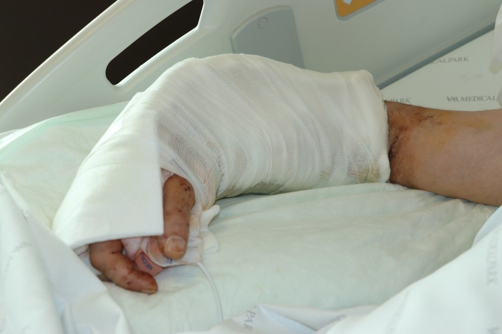 İş kazasında kopan kolu 12.5 saatte yerine dikildi