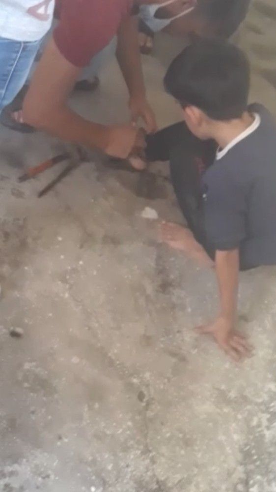 Ayağında zincirle bağlı çocuk alevler arasında kaldı