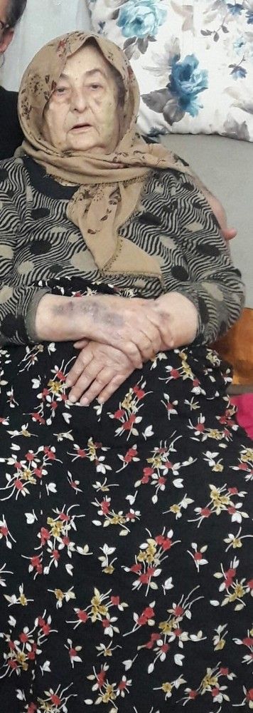 Özel hastanede ihmalden korona kapan yaşlı kadın öldü
