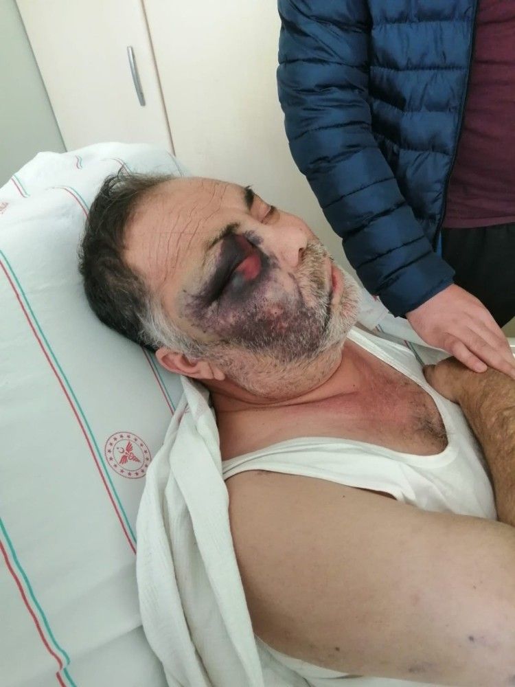 Yüzde 90 engelli adamı öldüresiye darp ettiler