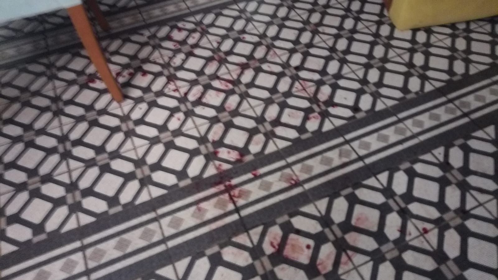 Belediye Başkanına beyzbol sopalı saldırı