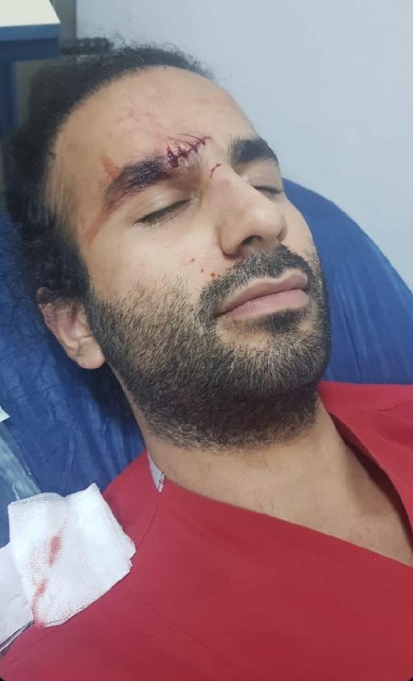 Polislerin yanında doktora kafa attı!