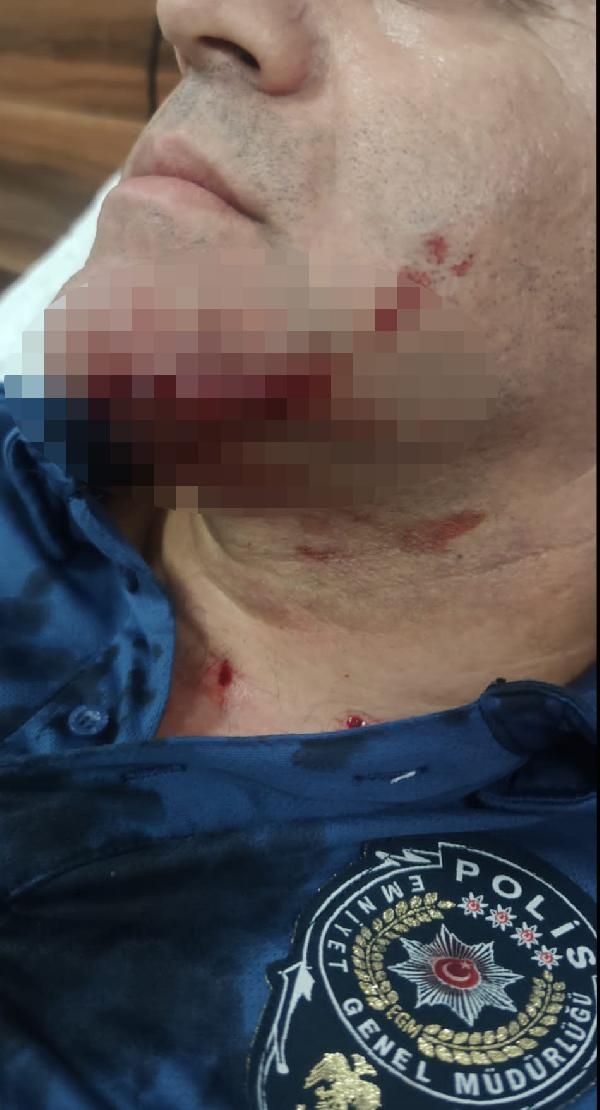 Polisi bıçakla yüzünden yaralayan saldırgan serbest 