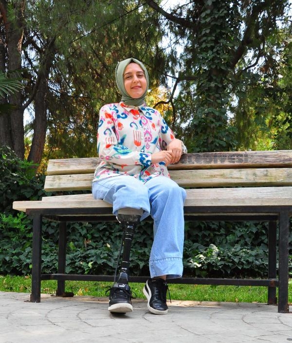 Tek bacağıyla hayata sıkı sıkıya tutundu