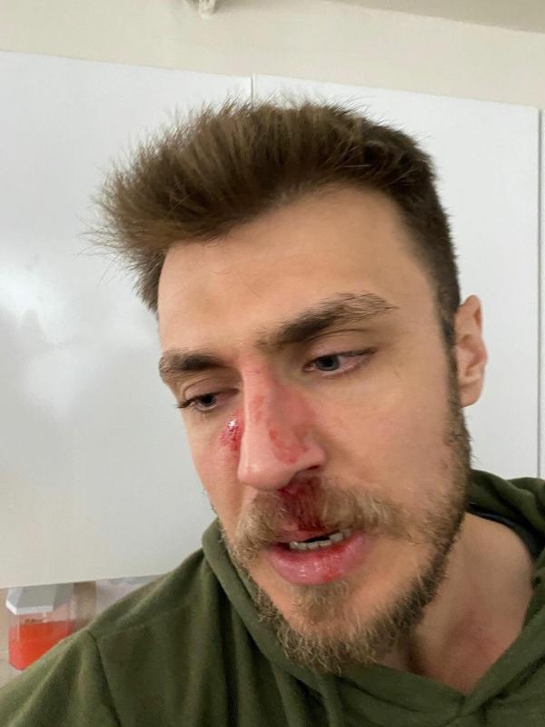 Dövülen doktor kafa travması geçirmiş