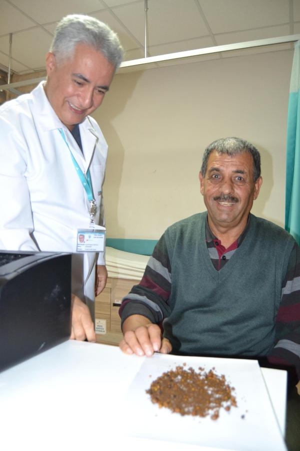 Safra kesesi taş ocağı gibi! 4 bin 536 taş çıktı
