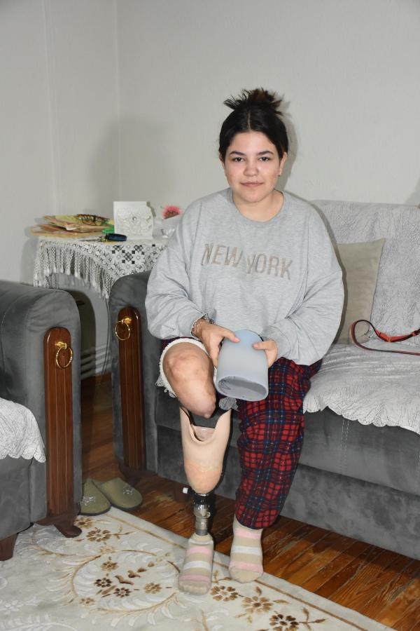 Liseli Melis'e 8 ayda bir bacak takılıyor