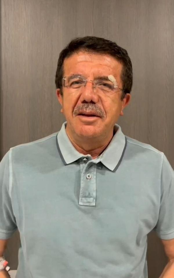 Kazada yaralanan eski Bakan Zeybekci, taburcu