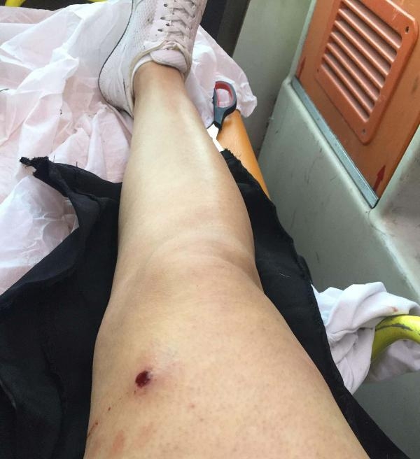 Eski eşini bacaklarından vuran kocaya 12.5 yıl hapis istemi