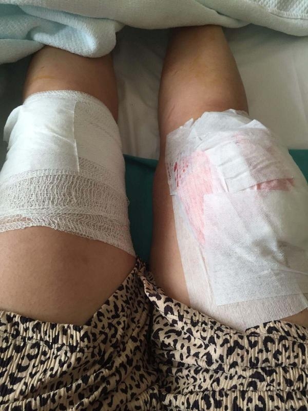 Eski eşini bacaklarından vuran kocaya 12.5 yıl hapis istemi