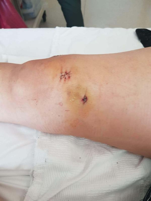 Eski eşini bacaklarından vuran kocaya 12.5 yıl hapis istemi