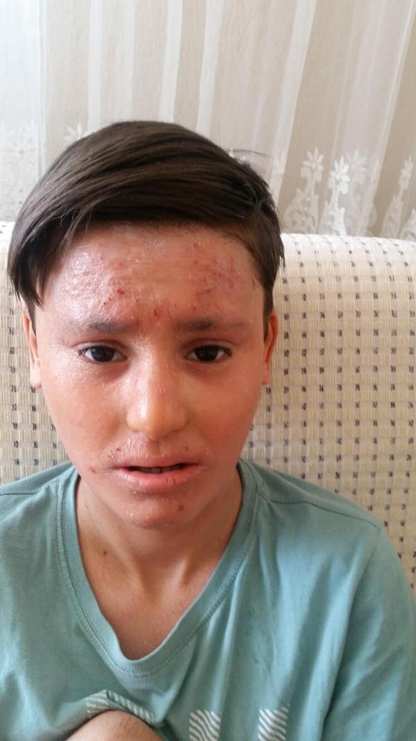 Gündüzleri evden çıkamıyor