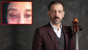 Bu ifadeyi verdi: Dövmedim, elim yüzüne çarptı!