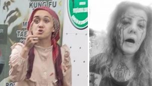 Kediler yüzünden saldırıya uğradı