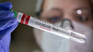 Erkekler ve kadınlar farklı Covid-19 semptomları yaşıyor